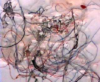 Fusselgeflecht, Bildquelle: Anne Dill